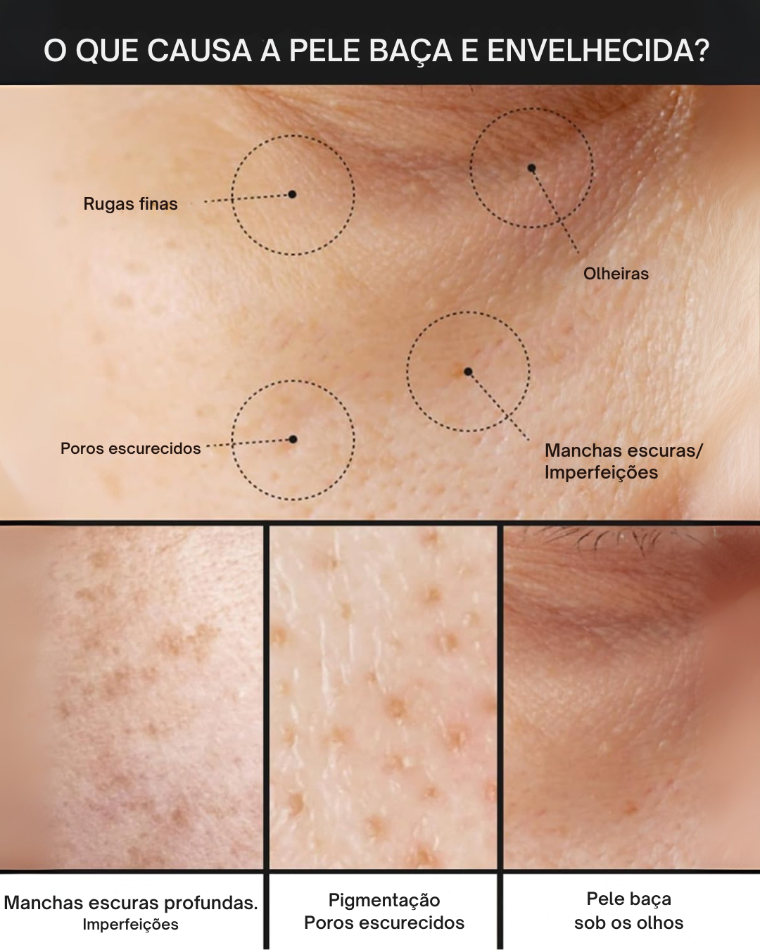 Creme Anti-manchas Pore+: Hidratante, Não Irritante e Redutor de Poros (EM PROMOÇÃO 2X1)®