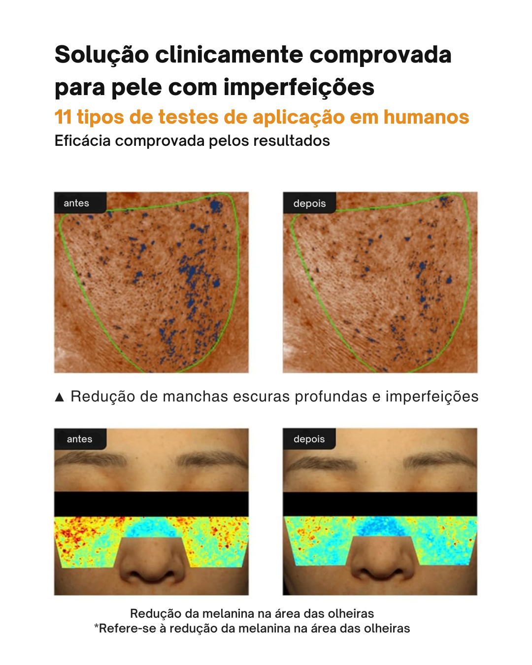 Creme Anti-manchas Pore+: Hidratante, Não Irritante e Redutor de Poros (EM PROMOÇÃO 2X1)®