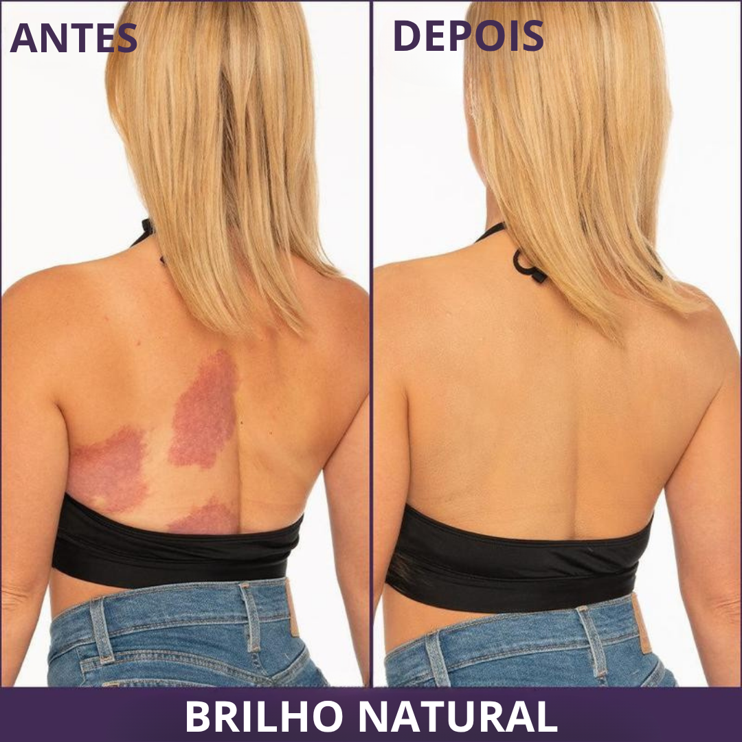 Maquilhagem corporal de alta cobertura para pernas e corpo (OFERTA 2X1)®